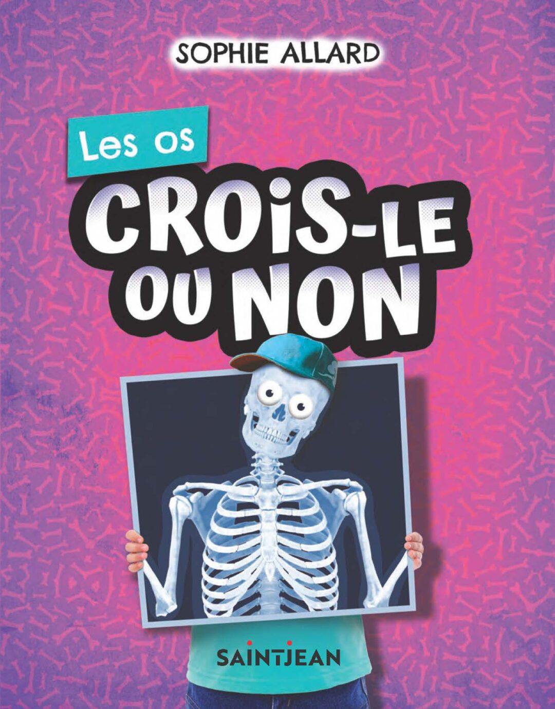 Crois-le ou non – Les os